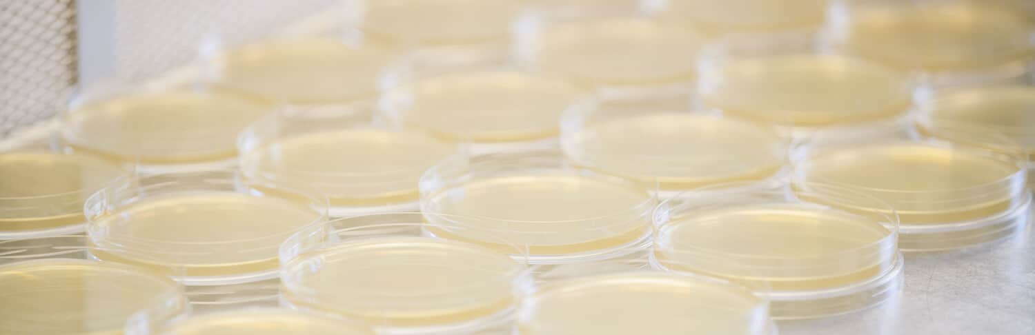Rows of light yellow agar plates in a laboratory