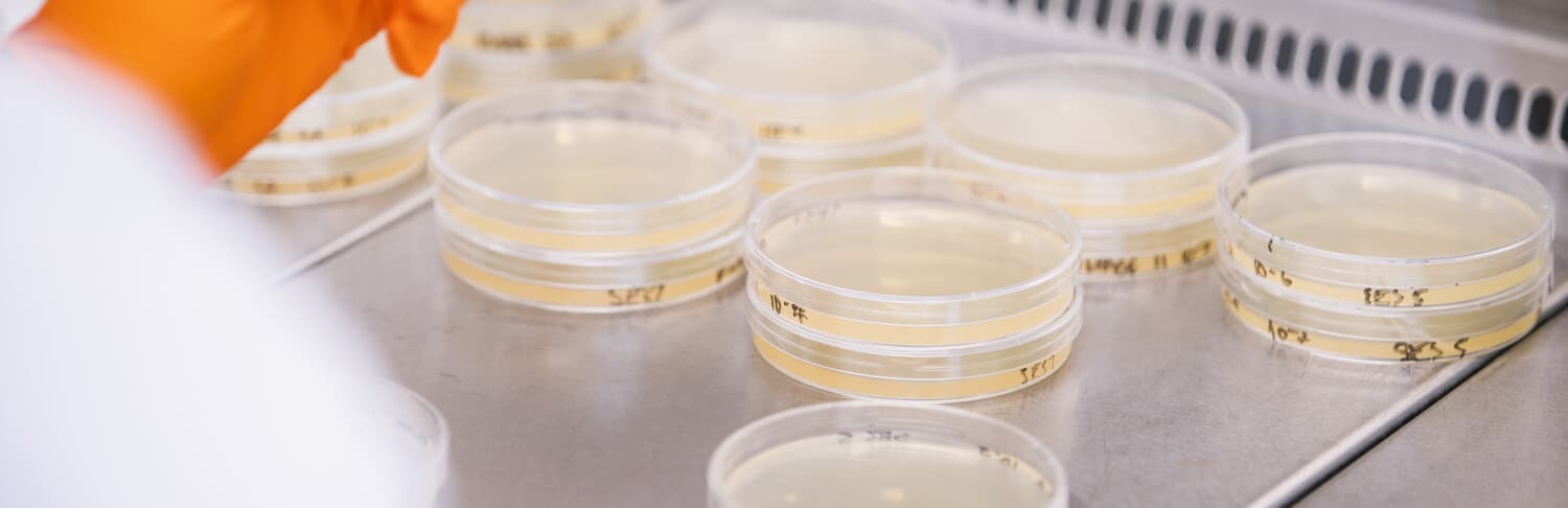 Rows and stacks of light yellow agar plates in a laboratory