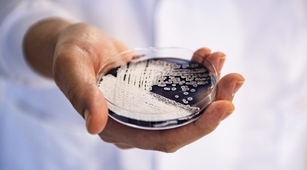 A dark purple agar plate covered in white microbial colonies