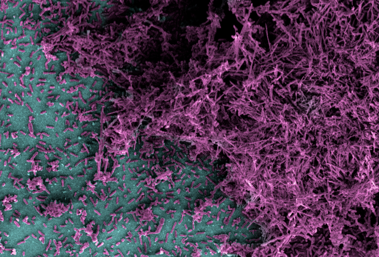 Microscope image showing a large group of Geobacter microbes coloured in purple on a teal surface